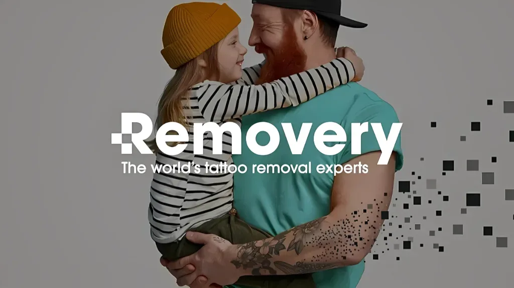 Removery Tattoo Removal & Fading — Tattoo removal service in Sacramento